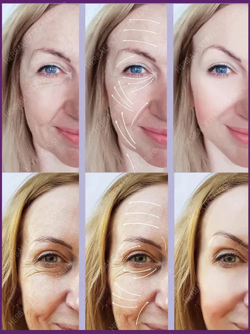 CONTORNO DE OJOS ANTIRARRUGAS"®️ ⭐⭐⭐⭐⭐ ORIGINAL - De Shopping Store