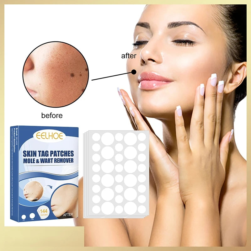 skin tag patches®️⭐⭐⭐⭐⭐ ORIGINAL - De Shopping Store